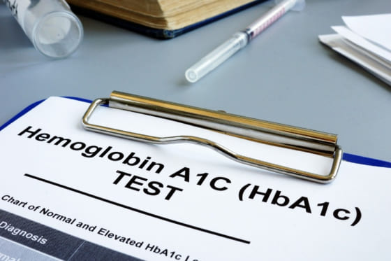 Proviamo a definire le specifiche di qualità analitica dell’HbA1c