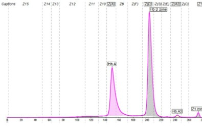Scheda clinica caso 14 paziente 1 b